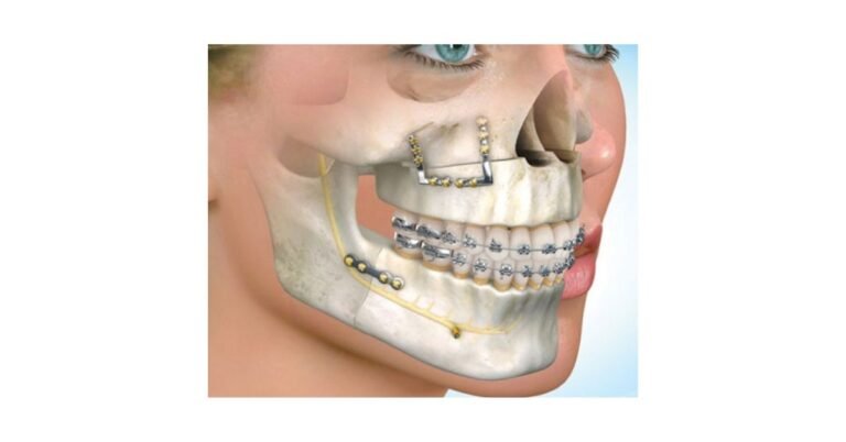 Enhancing Lives with Maxillofacial Defect