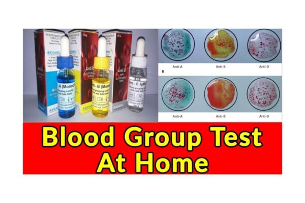 How to Check Your Blood Group at Home