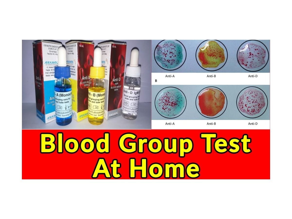 How to Check Your Blood Group at Home